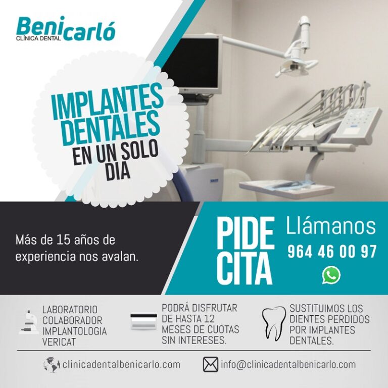 Implantes Dentales | Clínica Dental Benicarló